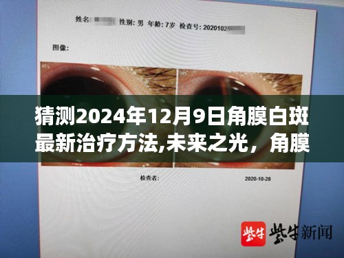 未來之光，角膜白斑新療法的探索與自我超越之旅——預(yù)測(cè)至2024年12月9日的最新治療方法