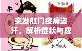 突發(fā)肛門疼痛盜汗，解析癥狀與應(yīng)對良方