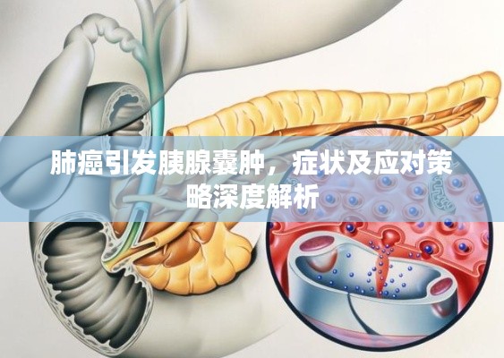肺癌引發(fā)胰腺囊腫，癥狀及應(yīng)對(duì)策略深度解析