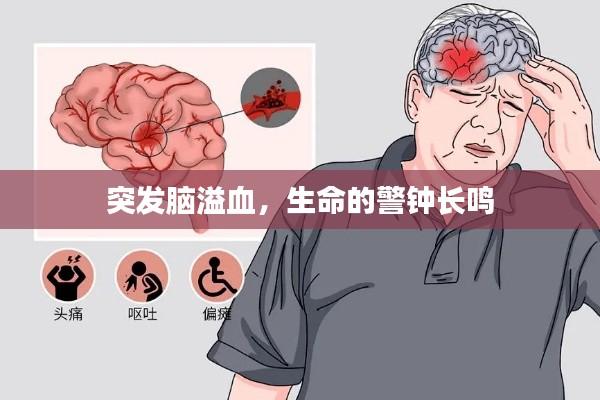 突發(fā)腦溢血，生命的警鐘長鳴