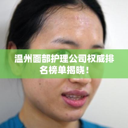 溫州面部護理公司權威排名榜單揭曉！