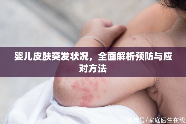 嬰兒皮膚突發(fā)狀況，全面解析預(yù)防與應(yīng)對方法
