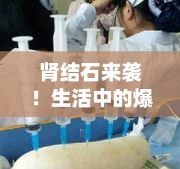 腎結石來襲！生活中的爆笑瞬間一網(wǎng)打盡！