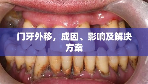 門牙外移，成因、影響及解決方案