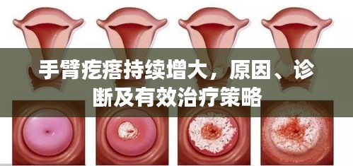 手臂疙瘩持續(xù)增大，原因、診斷及有效治療策略