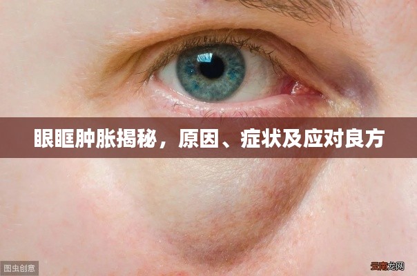 眼眶腫脹揭秘，原因、癥狀及應(yīng)對(duì)良方