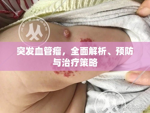 突發(fā)血管瘤，全面解析、預(yù)防與治療策略