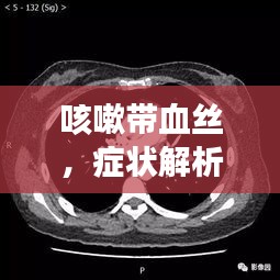 咳嗽帶血絲，癥狀解析、誘因探究及有效治療策略